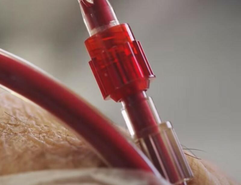 Fresenius Dialyse Fresenius Dialyse